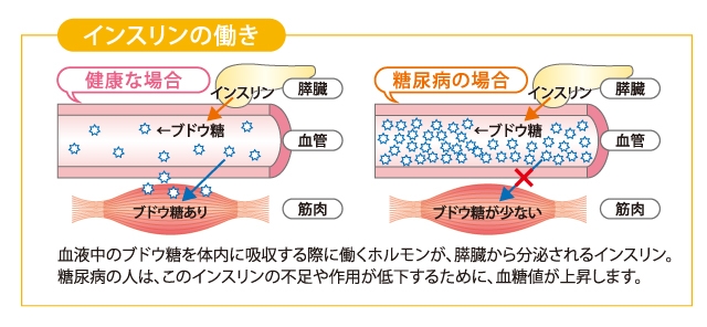 インスリンの働き.jpg